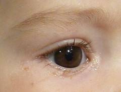 A mi bebé le lloran los ojos