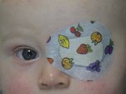 Oftalmología infantil Oftalmología infantil